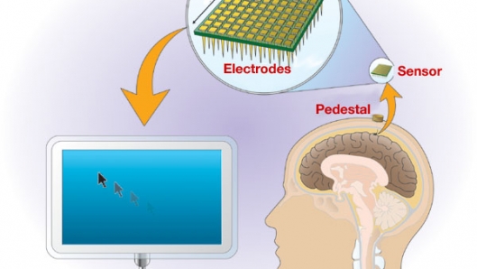 BrainGate for Thought-Controlled Computing
